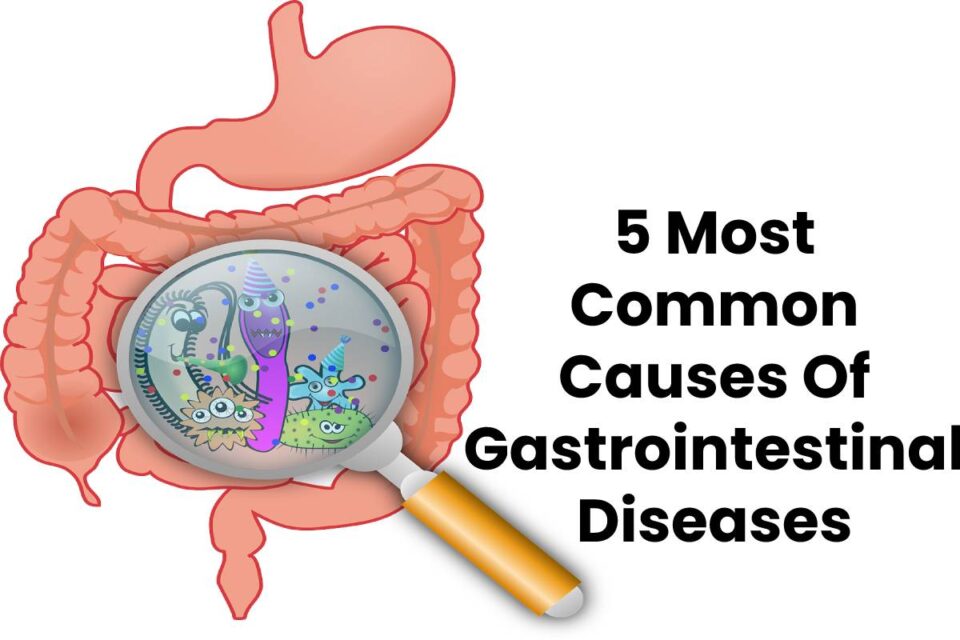 5 Most Common Causes Of Gastrointestinal Diseases