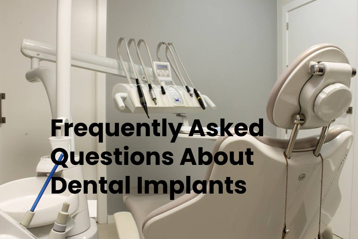 Frequently Asked Questions About Dental Implants