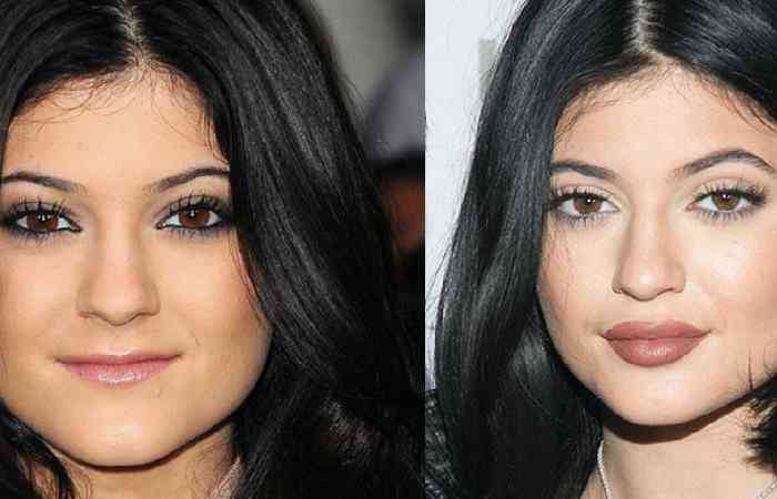 Apply Thin Lips to make them look Fuller