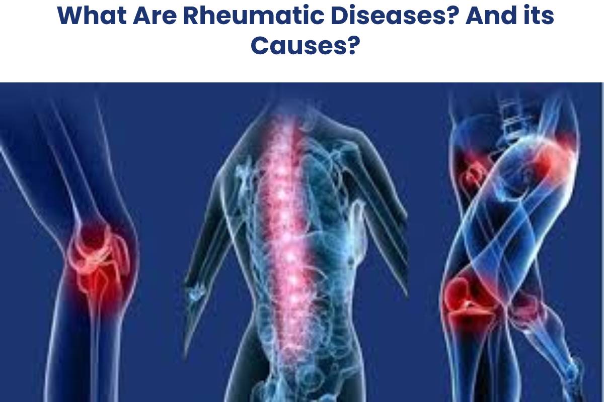 What Are Rheumatic Diseases? And its Causes?