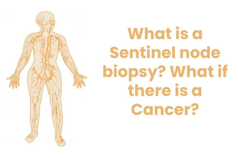 What is a Sentinel node biopsy? What if there is a Cancer?