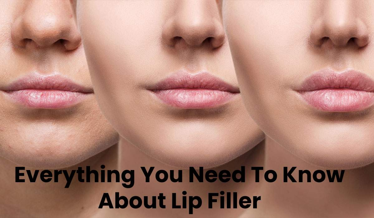 Everything You Need To Know About Lip Filler