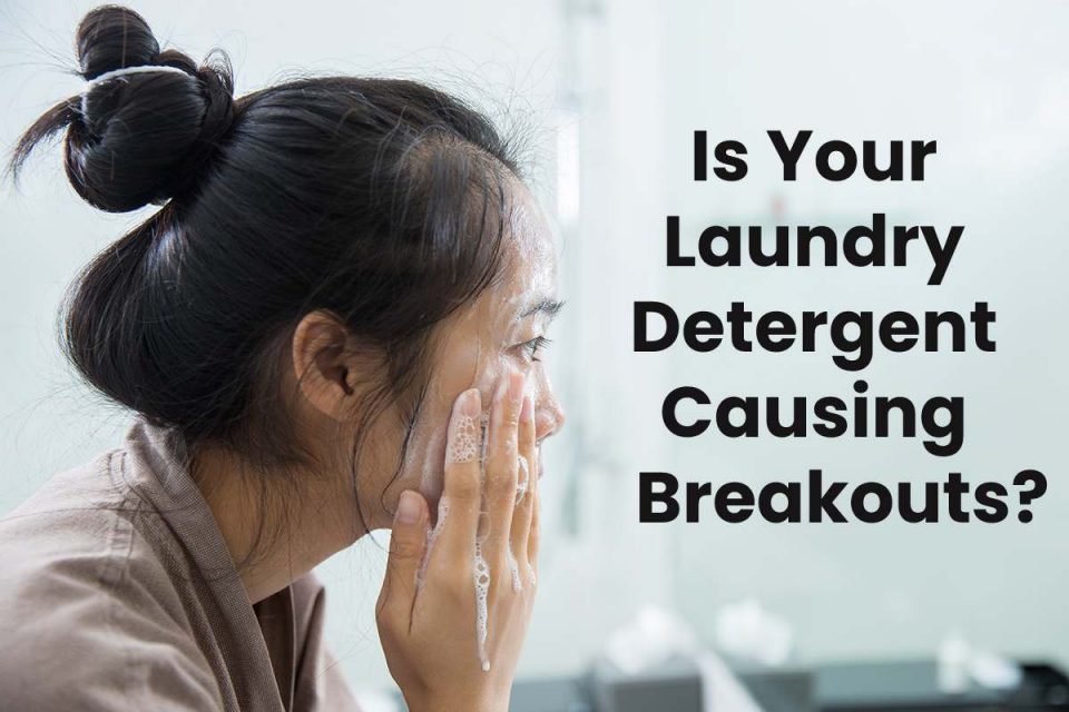 Is Your Laundry Detergent Causing Breakouts?