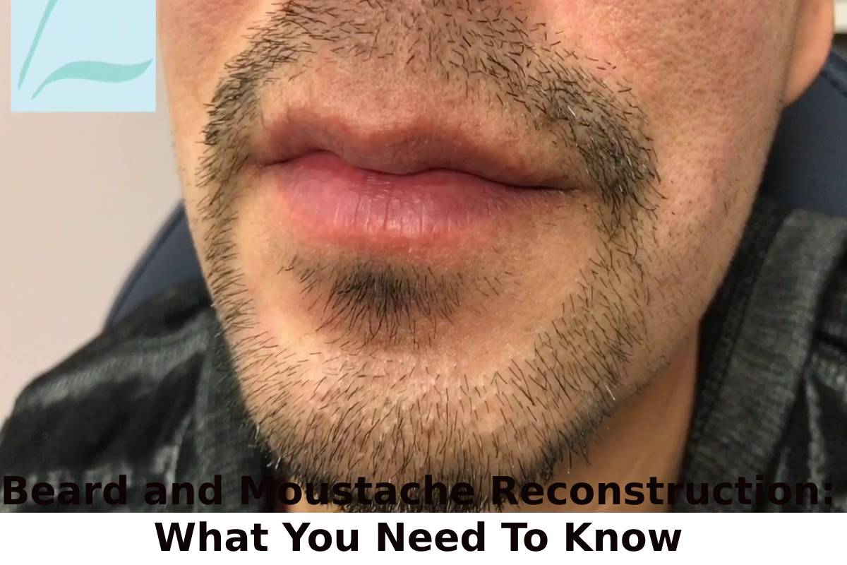 Beard and Moustache Reconstruction: What You Need To Know