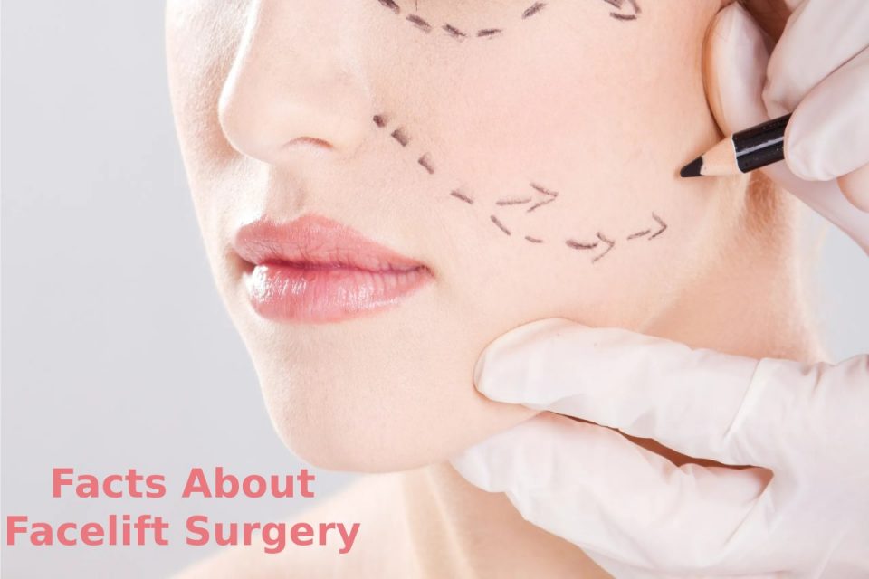 Facts About Facelift Surgery