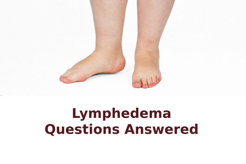 Lymphedema Questions Answered