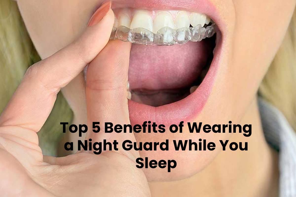 Top 5 Benefits of Wearing a Night Guard While You Sleep