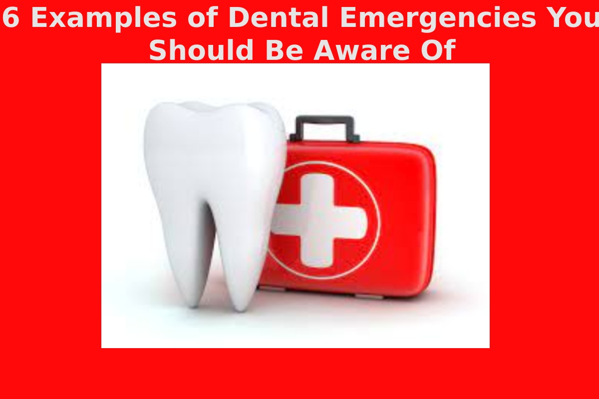6 Examples of Dental Emergencies You Should Be Aware Of