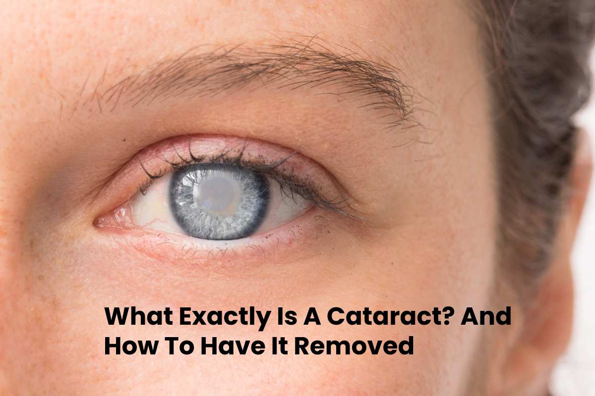 What Exactly Is A Cataract? And How To Have It Removed