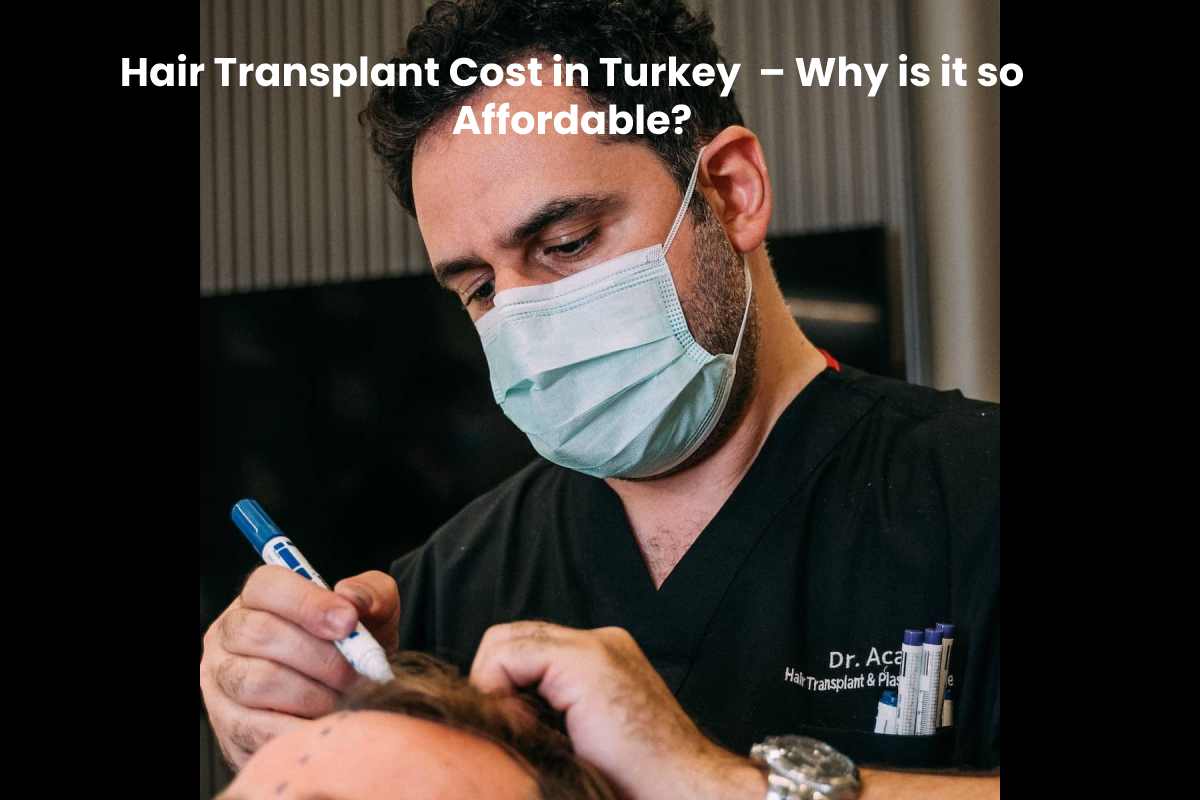 Hair Transplant Cost in Turkey - Why is it so Affordable?