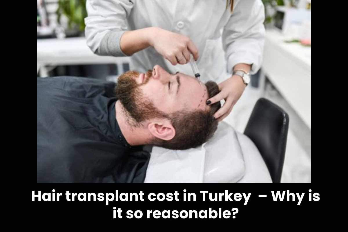 Hair transplant cost in Turkey – Why is it so reasonable?