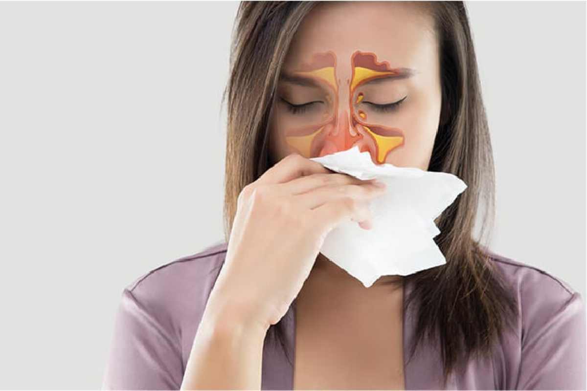 Different Types of Food For Sinus Infection