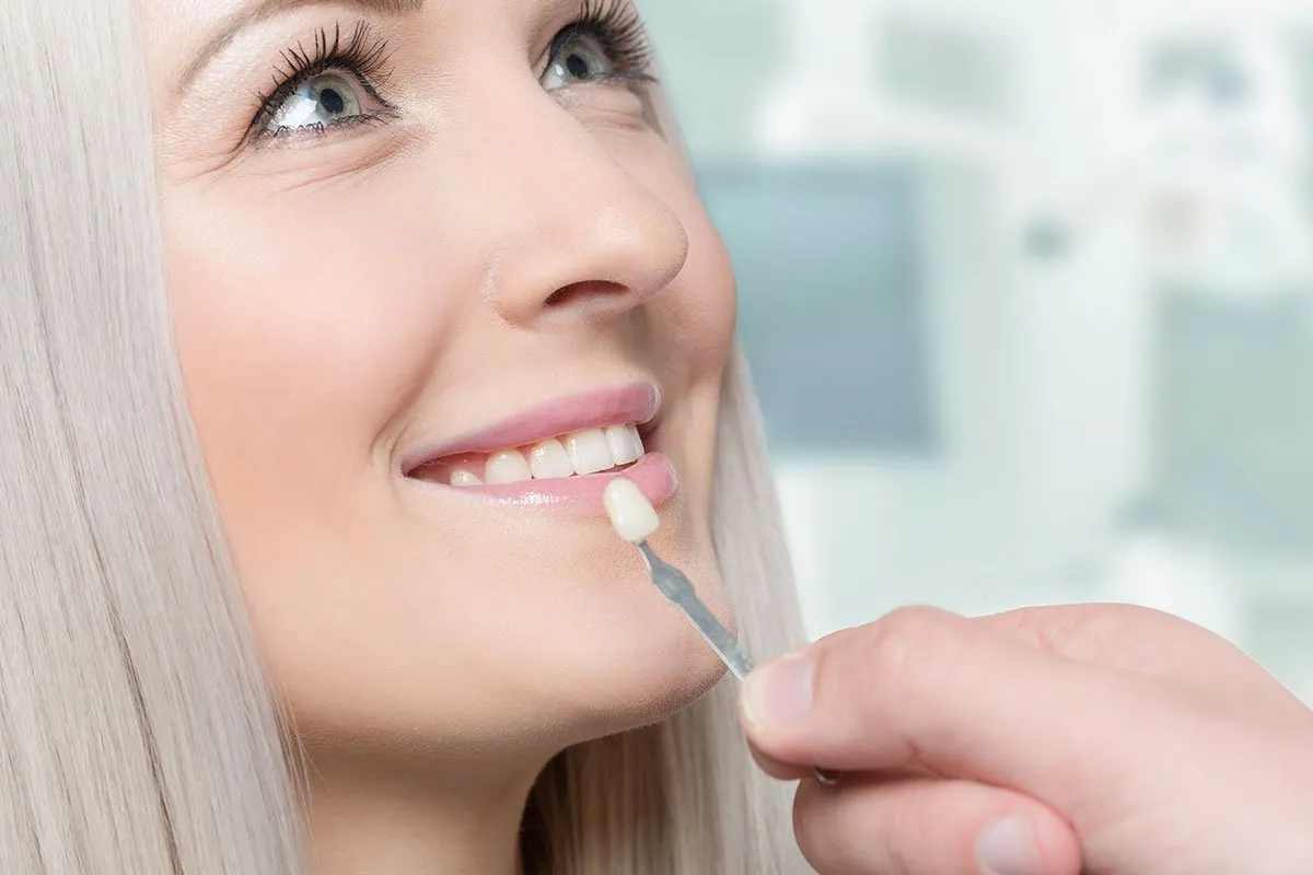 What Makes You a Perfect Candidate for the Porcelain Veneers?