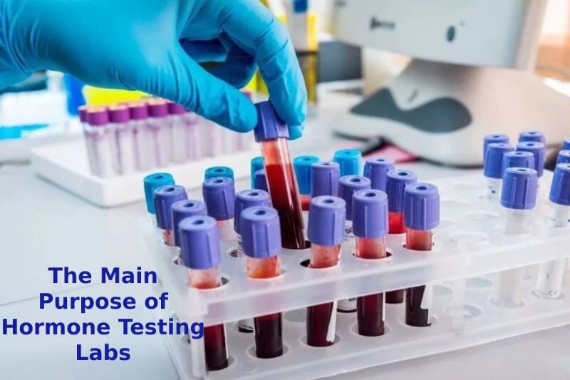 The Main Purpose of Hormone Testing Labs