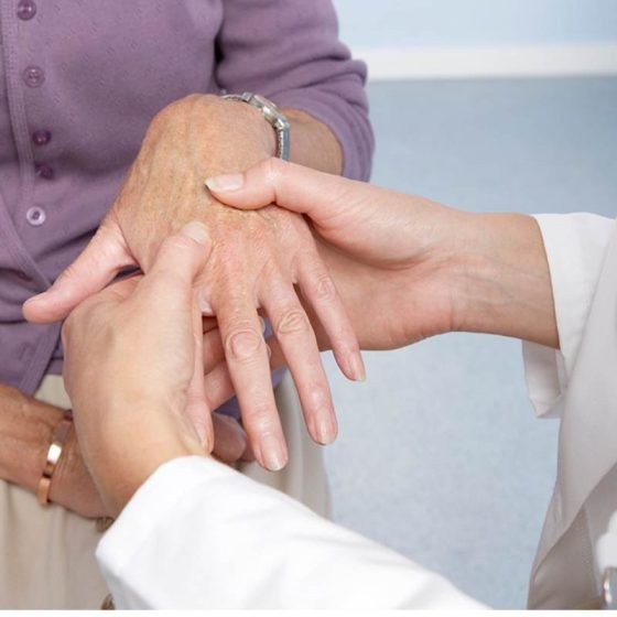Everything you need to know about Scleroderma