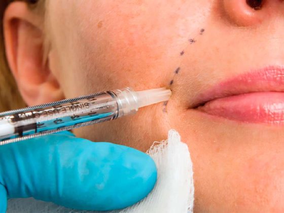 Facial Injectables and Fillers