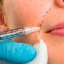 Facial Injectables and Fillers