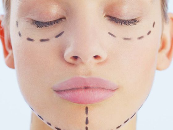 One-Stitch Facelift Vs Thread Lift