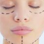 One-Stitch Facelift Vs Thread Lift