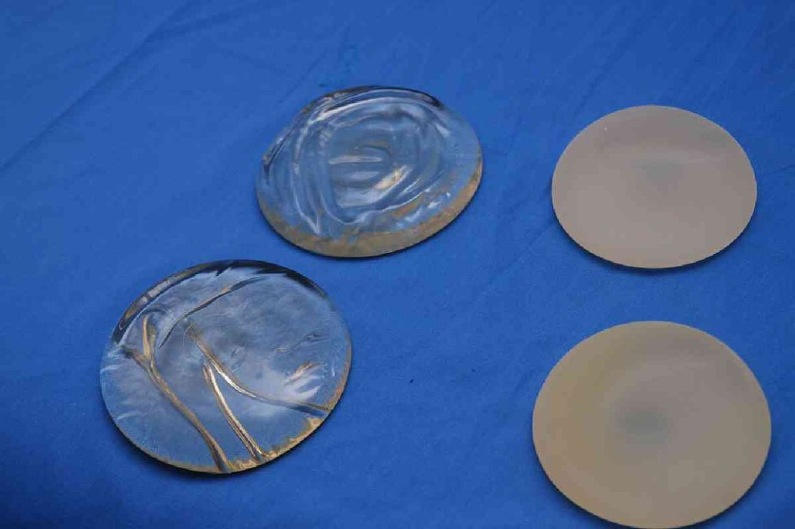 Silicone Breast Implant Removal