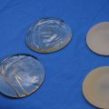 Silicone Breast Implant Removal