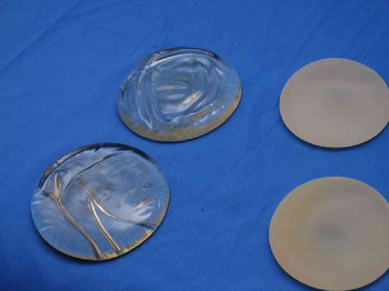 Silicone Breast Implant Removal