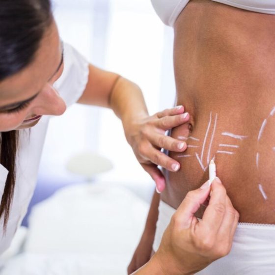 Body Contouring