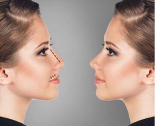 asian nose job procedure