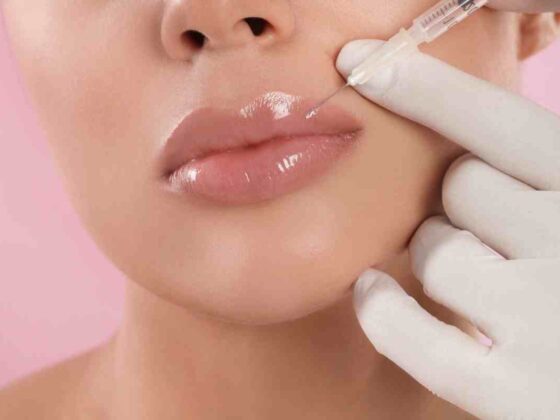 lip filler