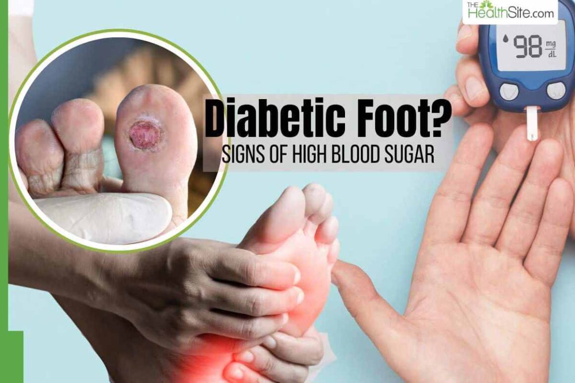 what are the symptoms of a high blood sugar level_