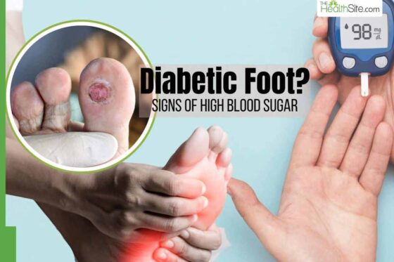what are the symptoms of a high blood sugar level_