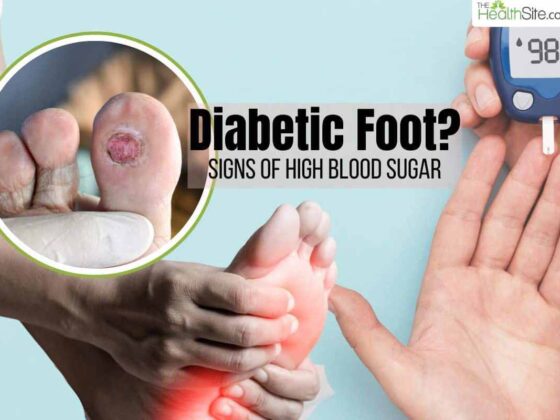 what are the symptoms of a high blood sugar level_