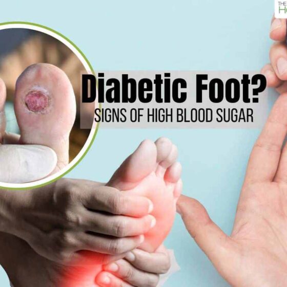 what are the symptoms of a high blood sugar level_