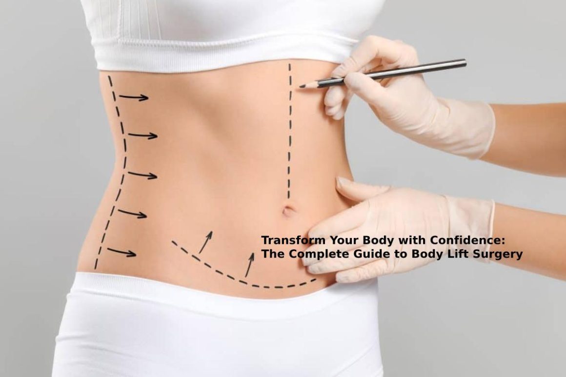 Body Lift Surgery